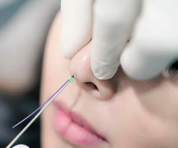 What Is a Nose Injection & How Much Does It Cost?